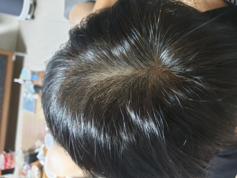 Day 40 of transition from year 9 to copy drug Proxia