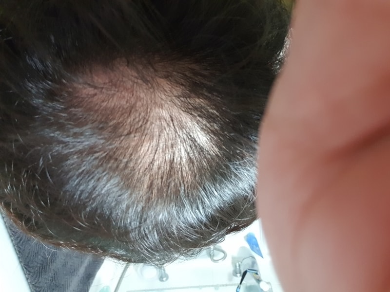 フペ 未収録（到着しない）開始 1ヶ月ごとに体験談