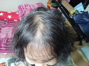 코스메르나 사용 전