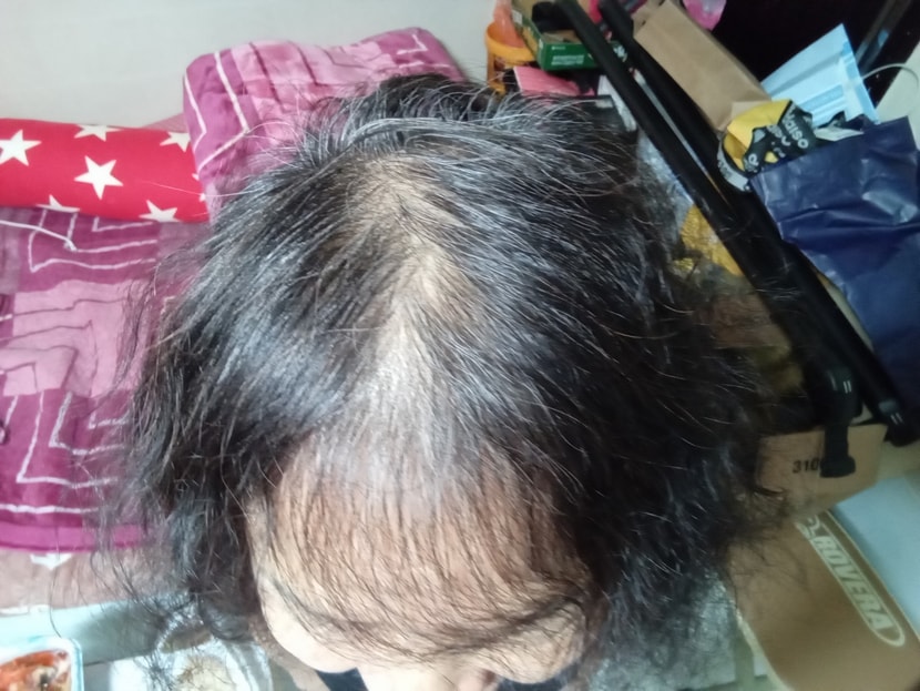 코스메르나 사용 전