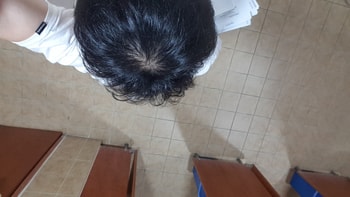 두달 복용후