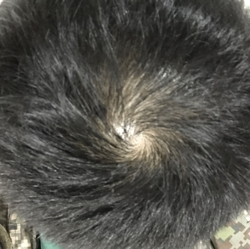 프페복용 30일차(1)