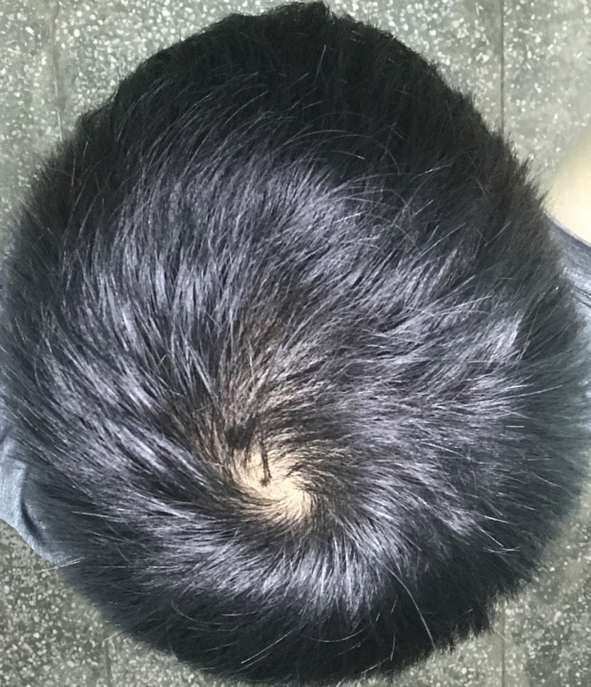 프페복용 110일차(조명아래)