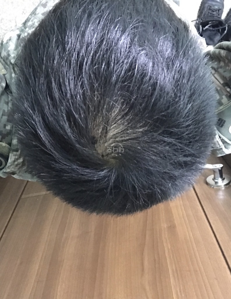 프페복용 30일차(2)