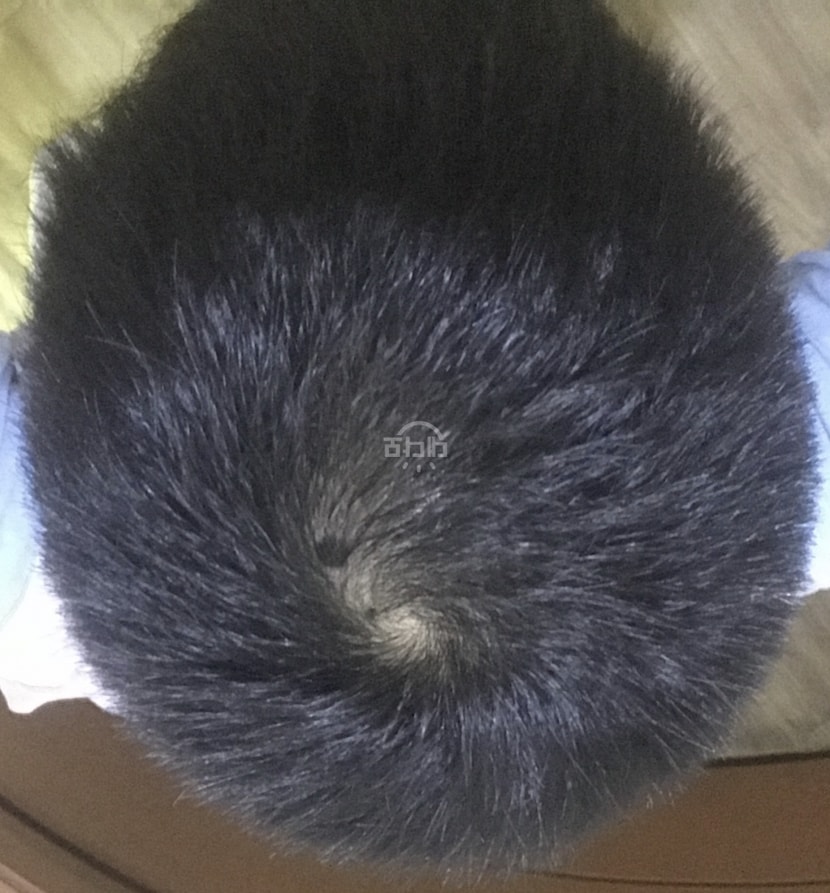 프페복용 70일차