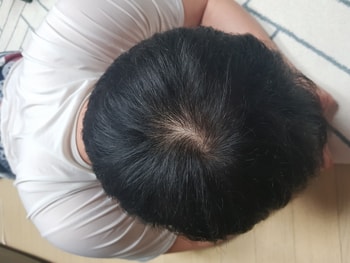 3개월차