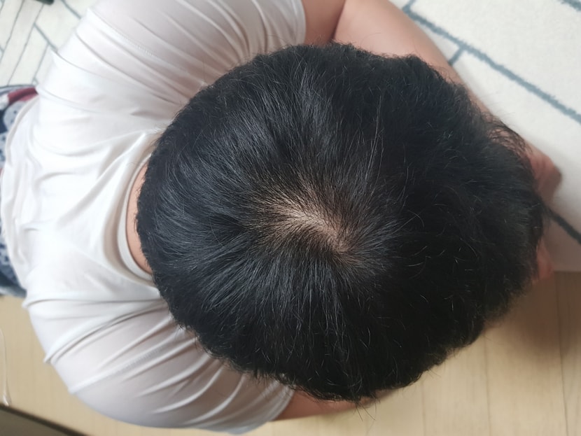 3개월차