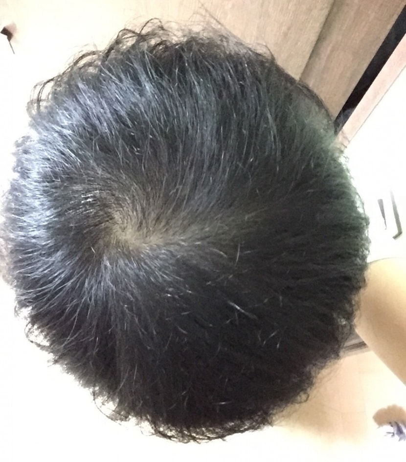 -15일 후