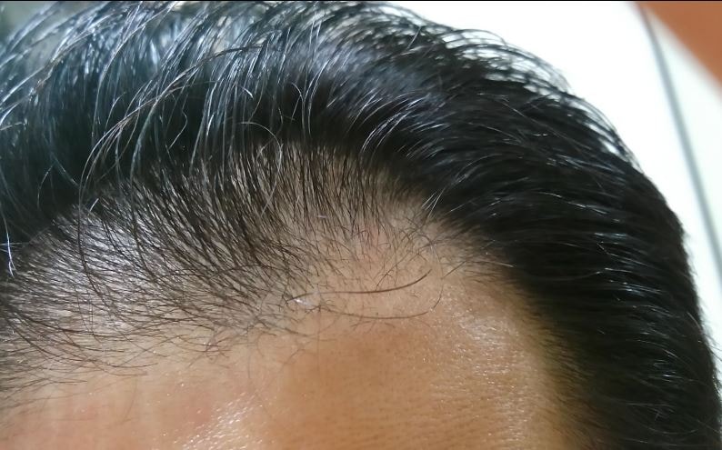 16년 9월_사진_3