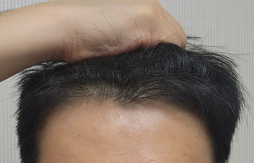 정면