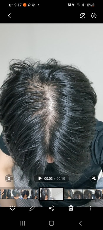 약바르고 바로 찍은거입니다