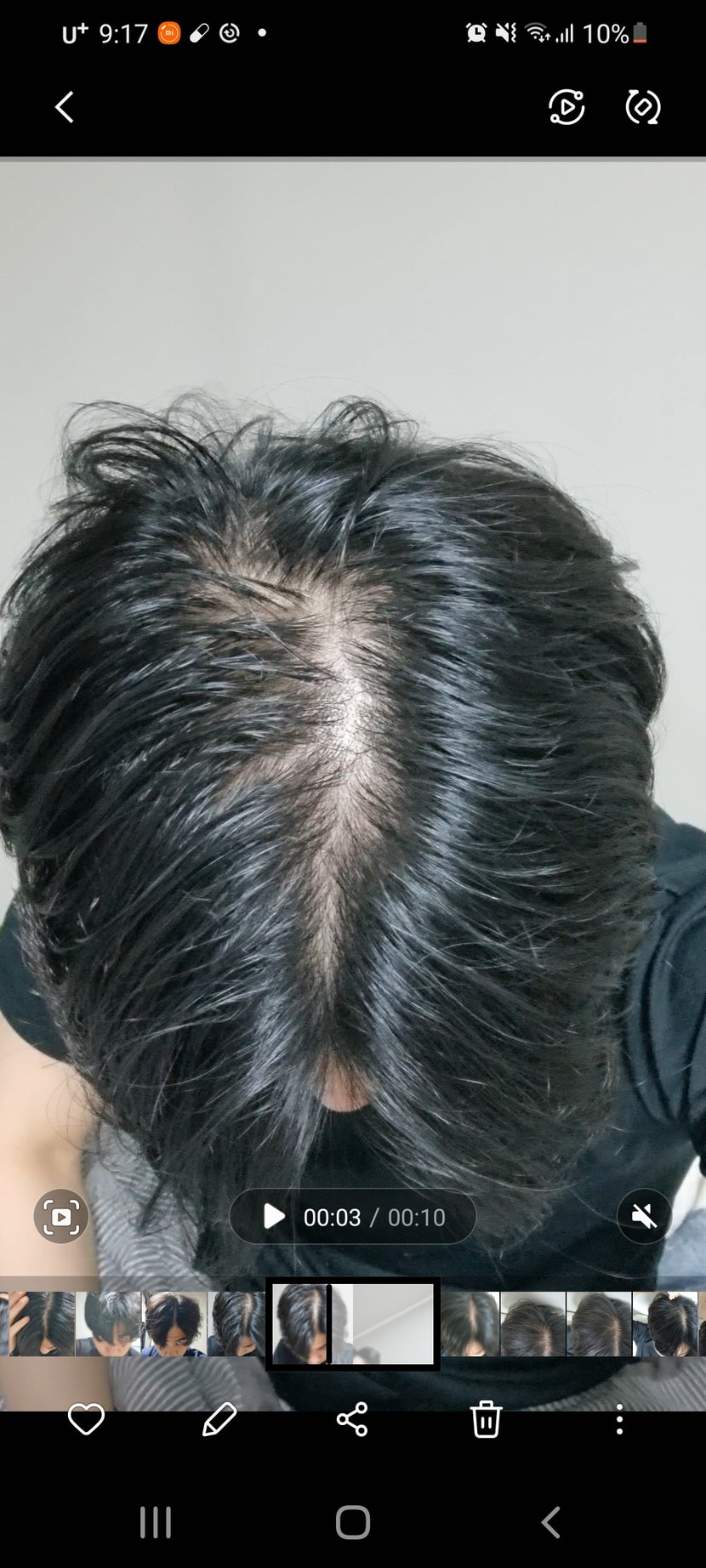 약바르고 바로 찍은거입니다