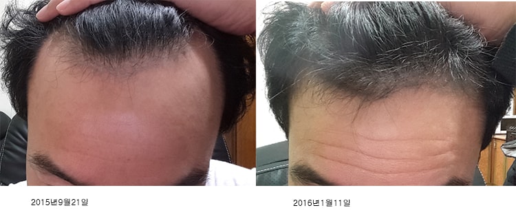 비교사진 추가합니다.