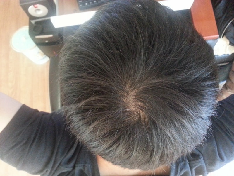 피로이드 3개월차 후기입니다...