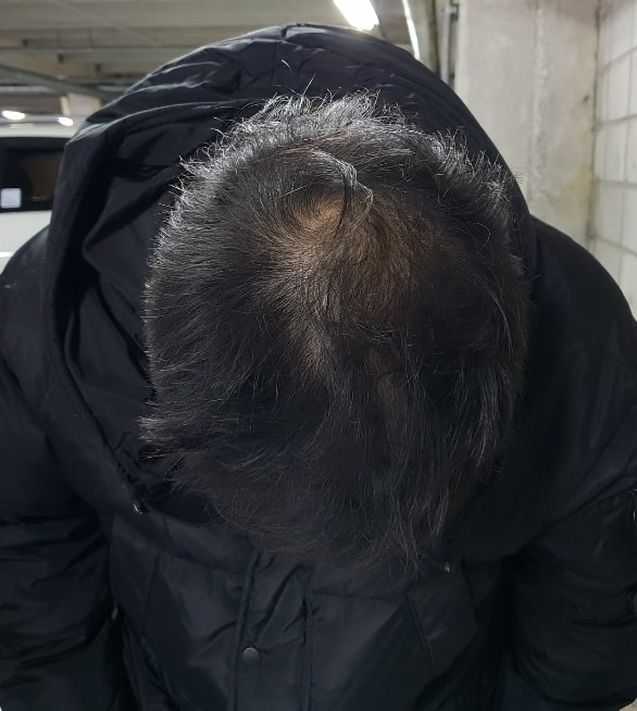 한달후