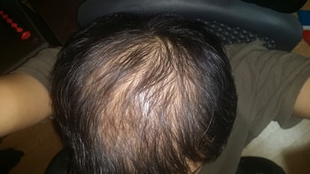 1년후 2014년 10월 현재