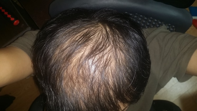 1년후 2014년 10월 현재