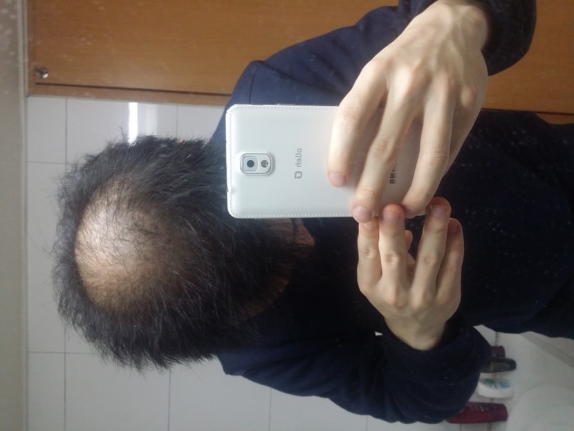 11개월전