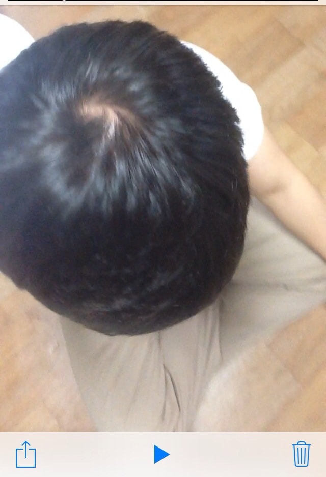 8개월째 복용중