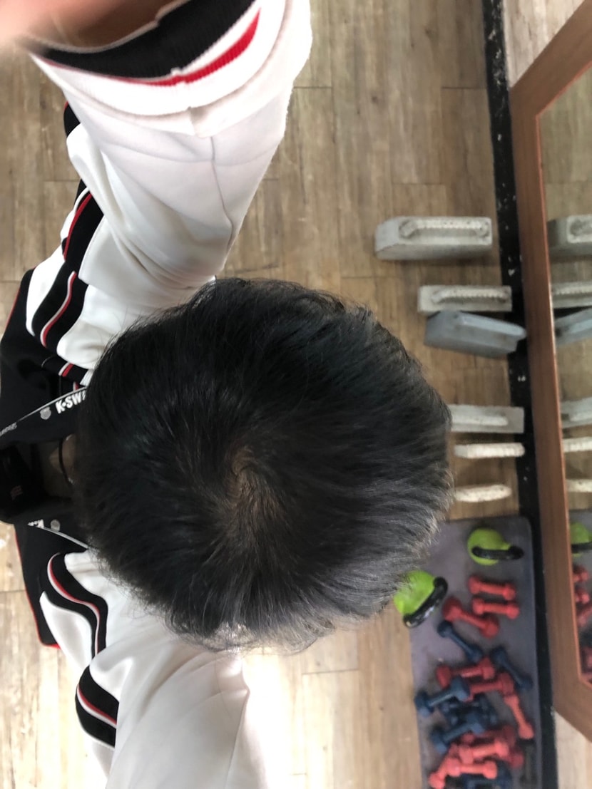 먹은후