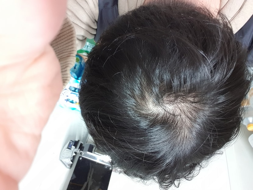 복용전1