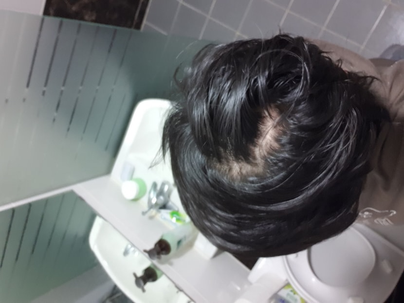 6개월차