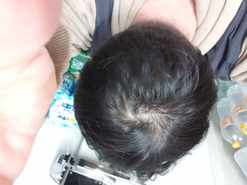 복용전2