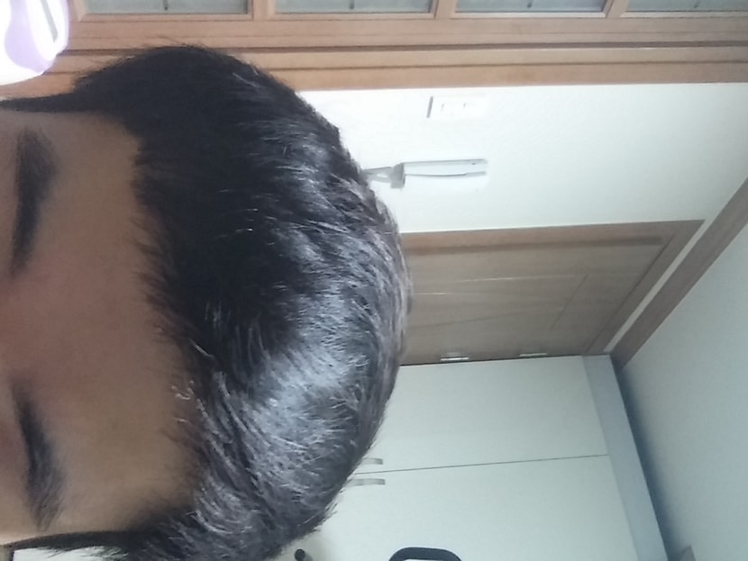 복용후