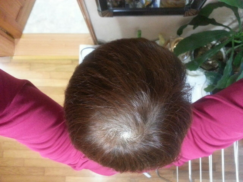 프카 3년차 사진올려봅니다~