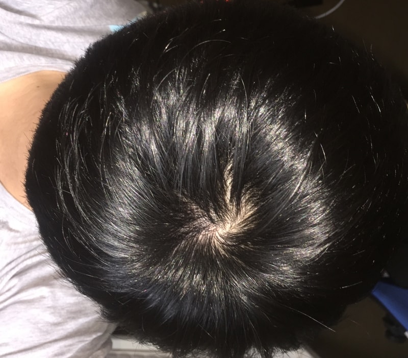 Hello, I'm in my 8th month.