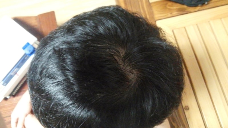 피나13일차