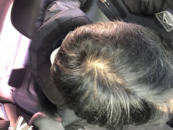 2018년 12월 핀페시아 1일차 복용