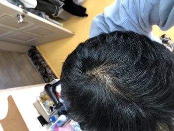 2018년 10월 로게인폼 2개월째