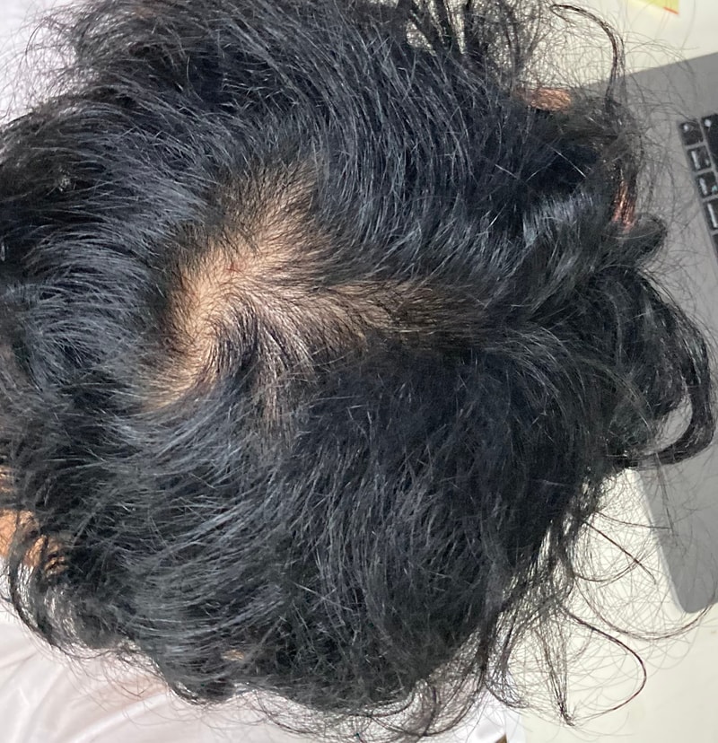 アボダート 6日目の記録用