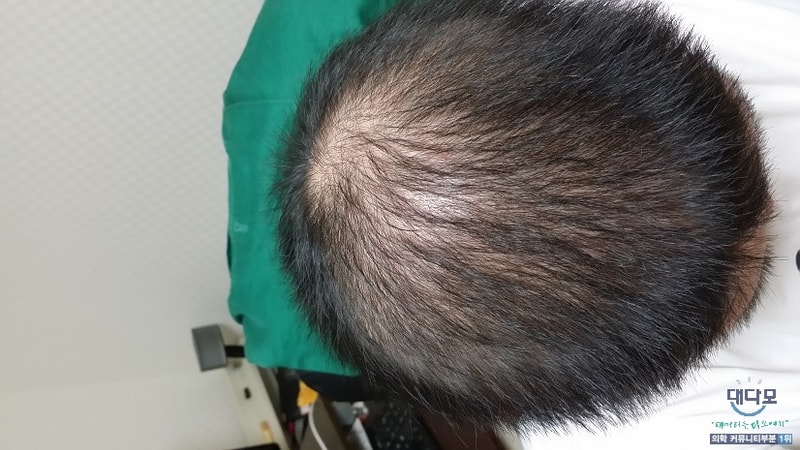 阿布扎特1年7个月后期