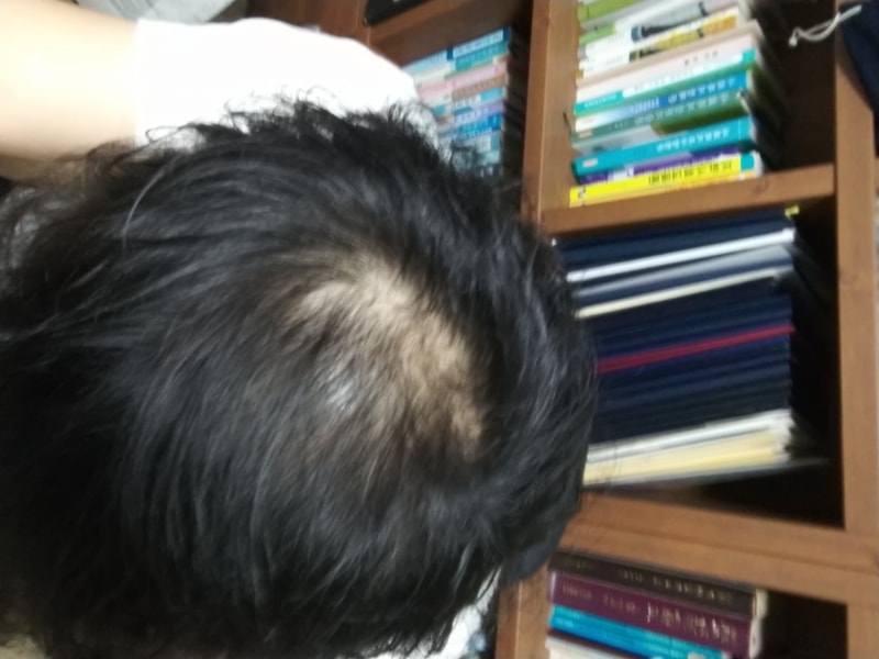 안녕하세요 아보+커클미녹 3개월차입니다.