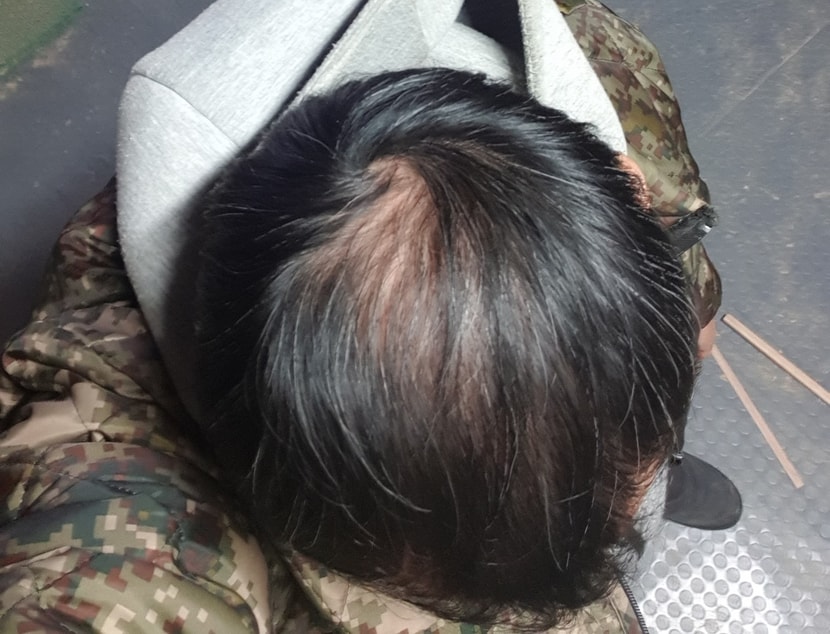6개월 후