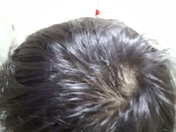 현재 가마 모양2