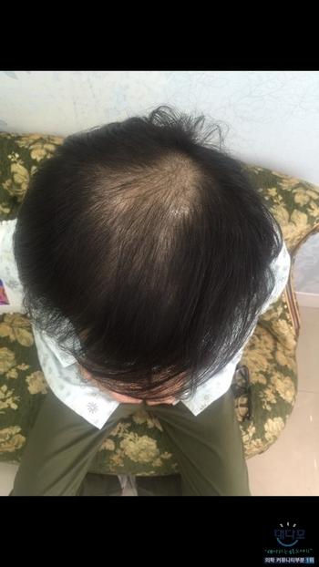 처방전 받으러 갔을때 머리 상태입니다