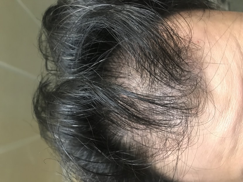 1년 전 사진