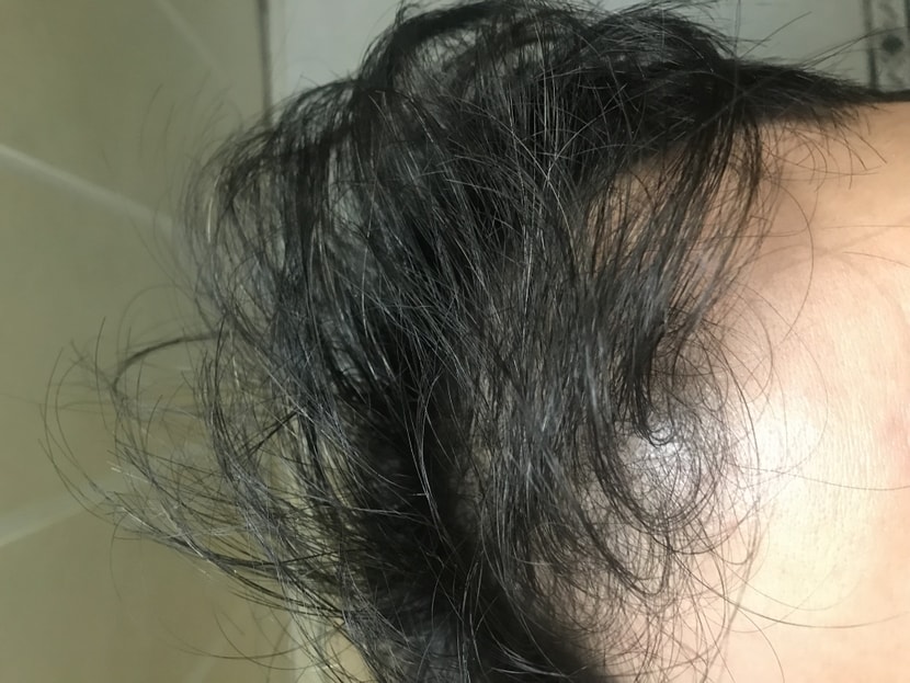 1년 전 사진