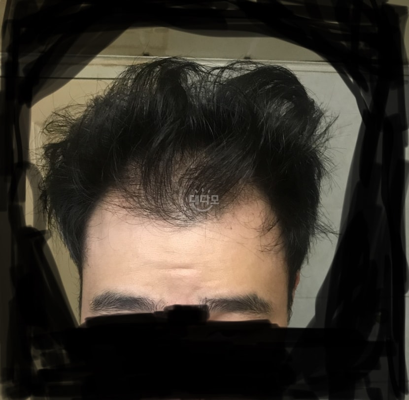 1년 전 사진