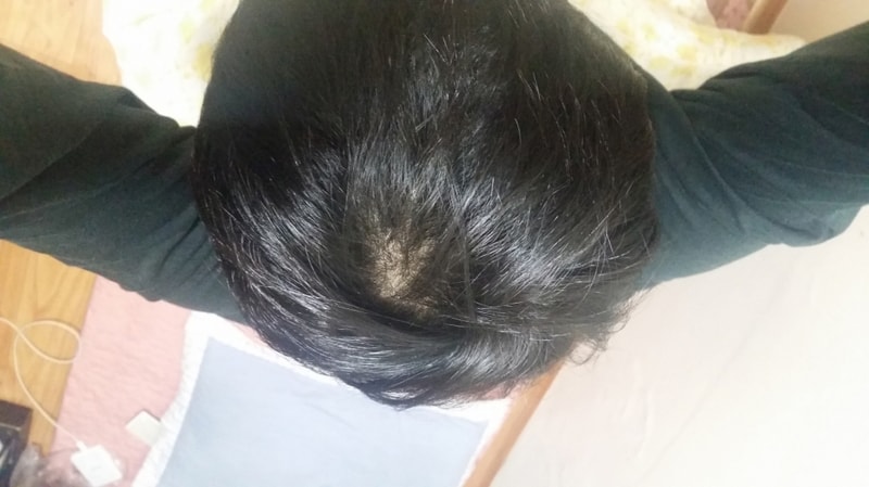 流血一个月后记。