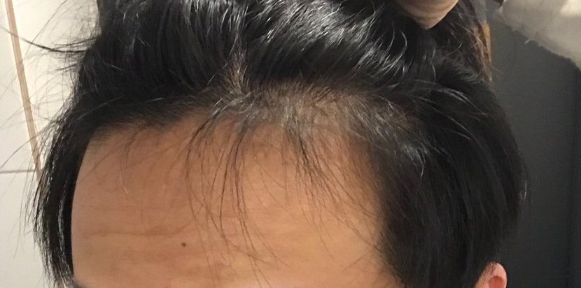 오늘.어두운 빛 (실제로는 저거보다 더 두피가 들여다보입니다.)