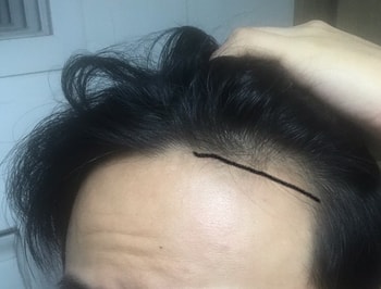 오늘.까만 선이 거의 원래 라인입니다.