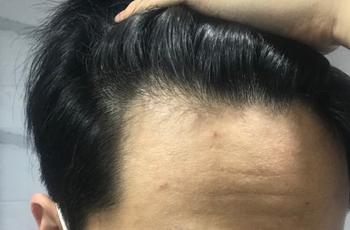 오른쪽