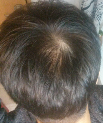 약 먹은뒤 7개월