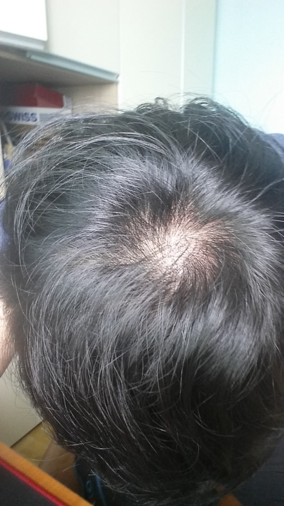 피나 3개월차입니다.