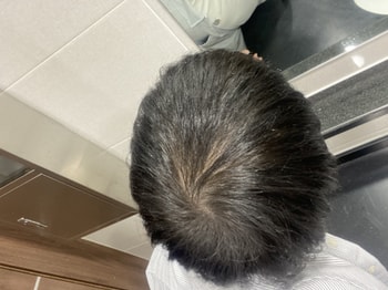 핀주브 먹고 털릴때 