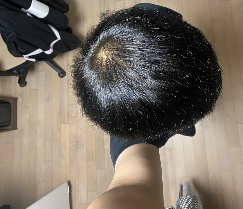 아보다트 